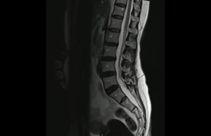 Resonancia magn&eacute;tica abierta de columna