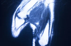 resonancia magn&eacute;tica abierta de mano